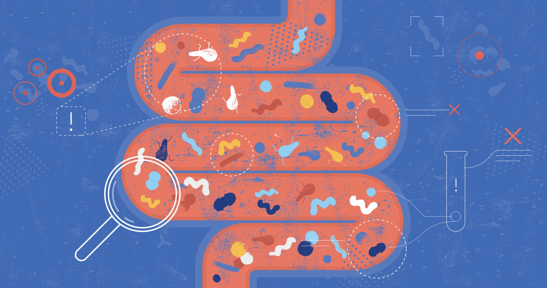 Illustration of the human gut with magnified bacteria, representing the gut microbiome.